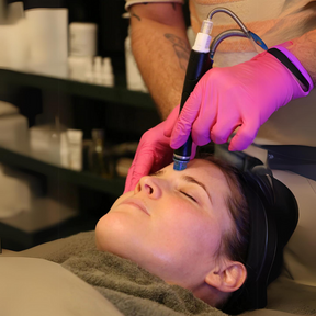 SieroSanto Platinum HydraFacial "Summer Glow" - Exclusive Offer