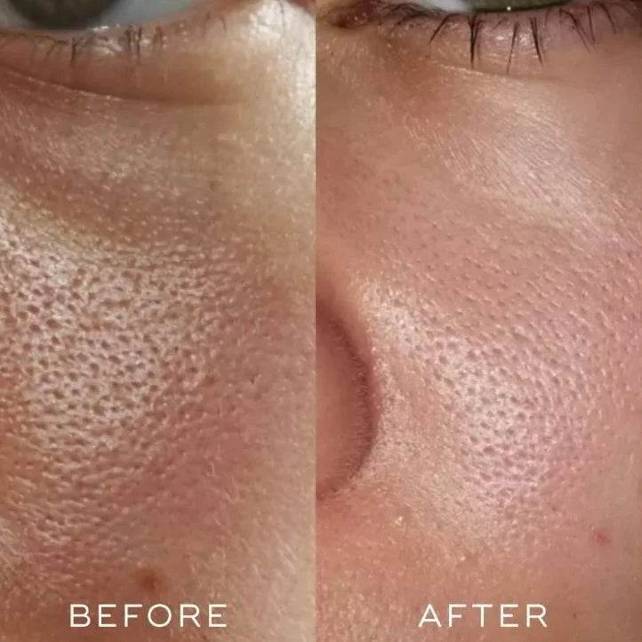 Medik8 PRESS & GLOW™ - SieroSanto