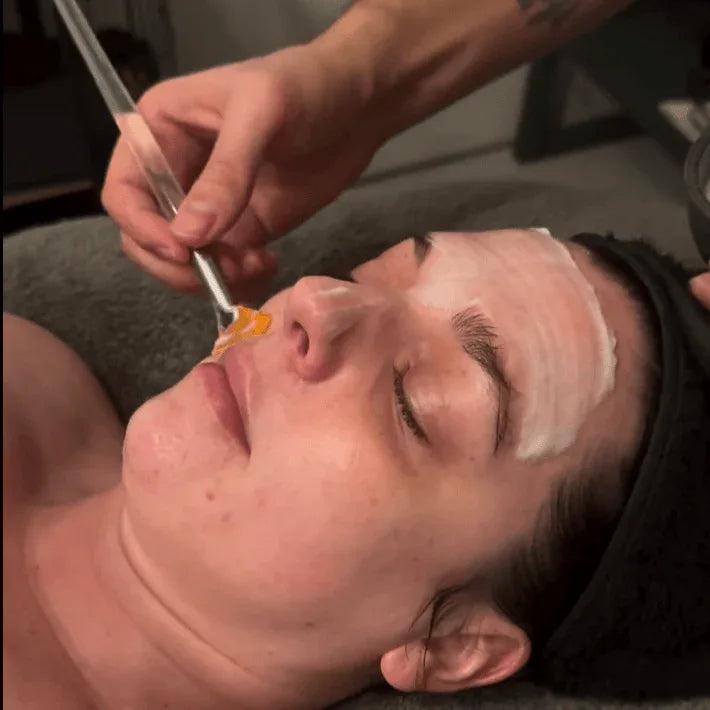 Deluxe HydraFacial Mini Pass (3 sessies) – Black Friday Edition - SieroSanto