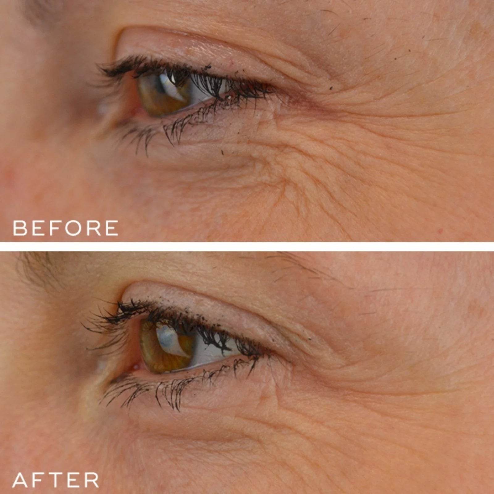 Medik8 CRYSTAL RETINAL 10™ - SieroSanto