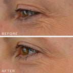 Medik8 CRYSTAL RETINAL 10™ - SieroSanto