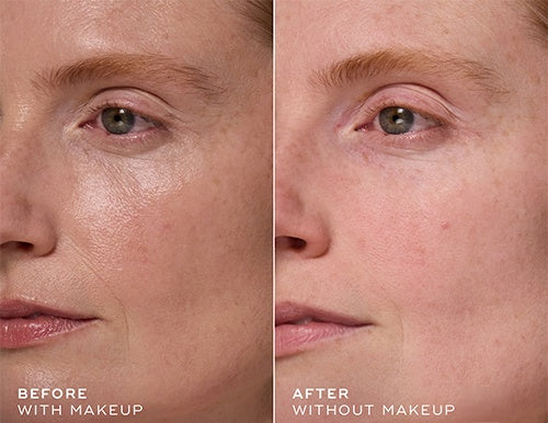 Medik8 - CSA Luxe Alles-in-één Kit (Gevoelige Huid) - SieroSanto
