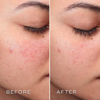 Medik8 PRESS & CLEAR™ REFILL - SieroSanto