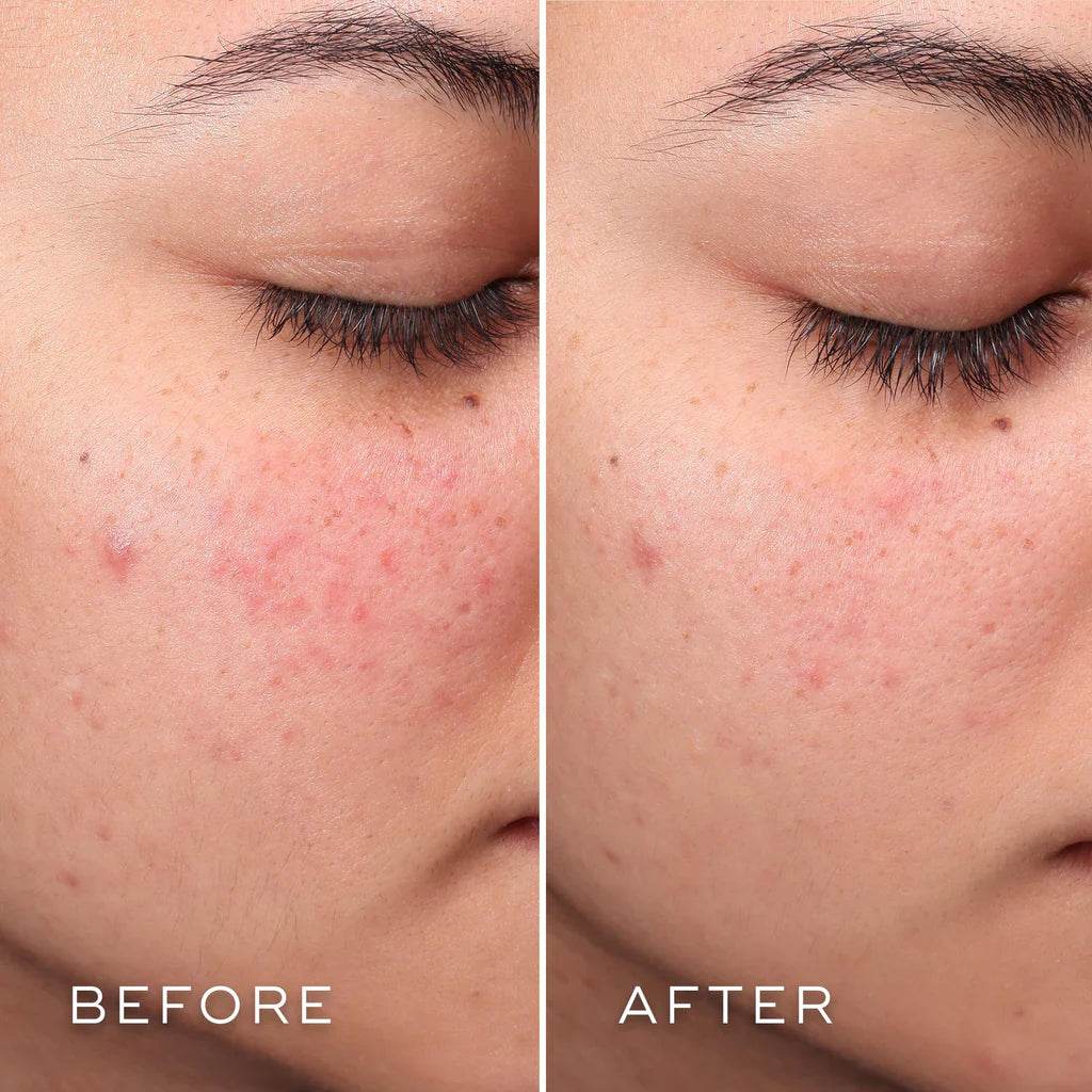 Medik8 PRESS & CLEAR™ REFILL - SieroSanto